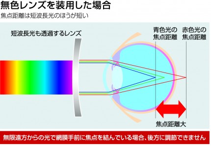 無色レンズを装用